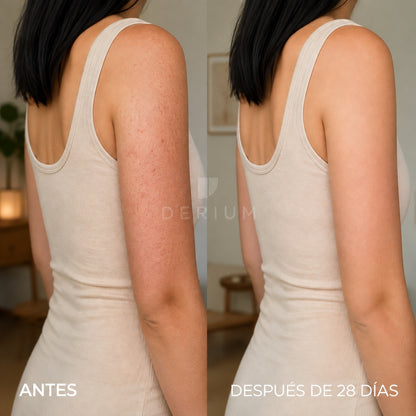 Crema 200g Tratamiento Textura — Piel de Gallina en Brazos y piernas